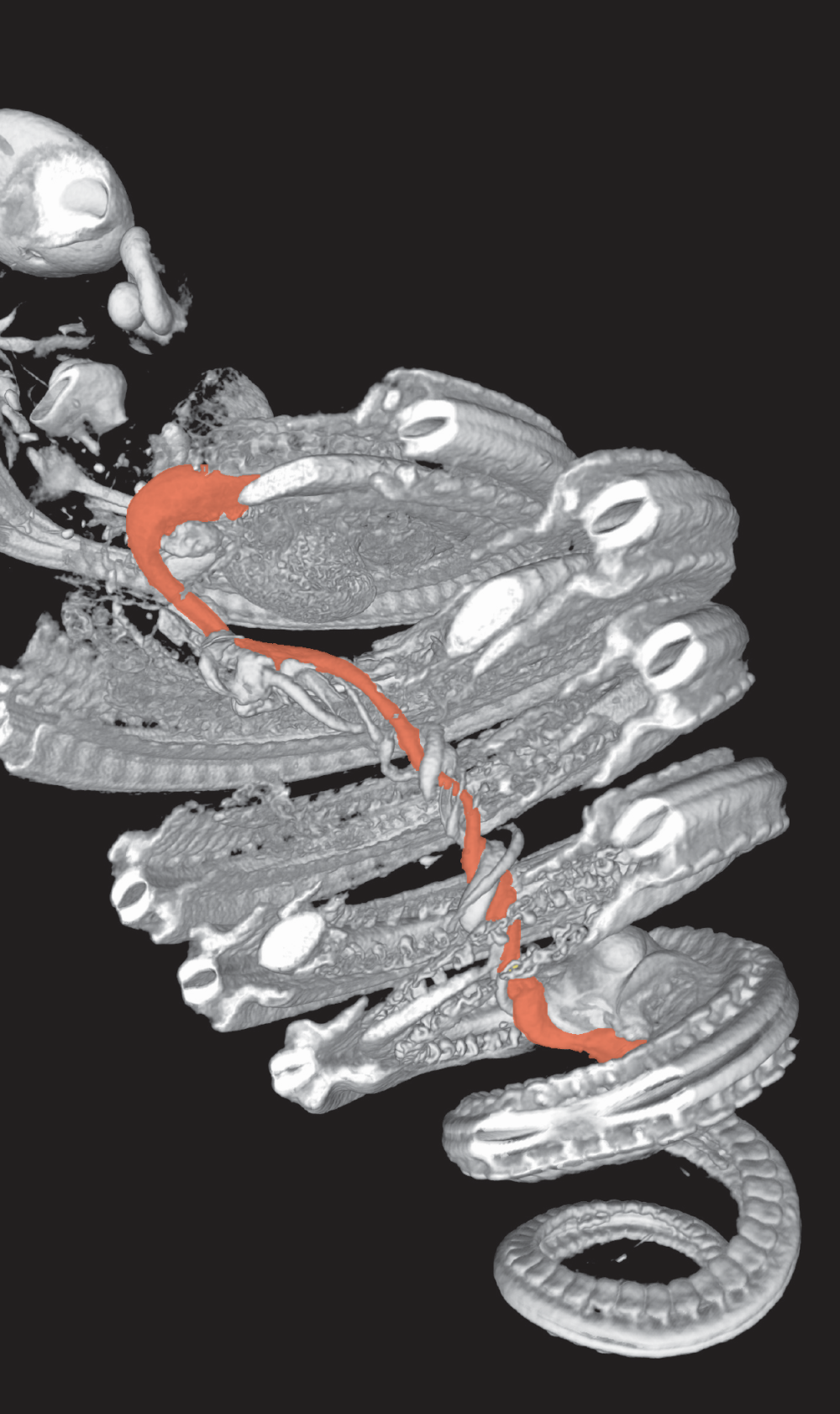 A cut-away view of a CT-scanned image embryo of Cape house snake (Boaedon capensis), revealing the 'visceral pillar' -- a newly discovered trait unique to snake embryos. The gut is separated from the body axis, as the latter begins to rapidly grow and buckle into coiling form. The gut becomes integrated again later when its growth catches up with the rest of the body A cut-away view of a CT-scanned image embryo of Cape house snake (Boaedon capensis), revealing the 'visceral pillar' -- a newly discovered trait unique to snake embryos. The gut is separated from the body axis, as the latter begins to rapidly grow and buckle into coiling form. The gut becomes integrated again later when its growth catches up with the rest of the body